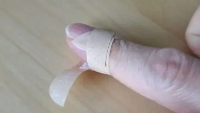 تفسير جرح الاصابع في المنام