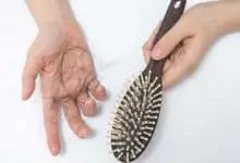 علاج تساقط الشعر بالاعشاب