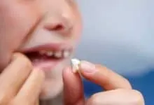 سقوط الاسنان في المنام