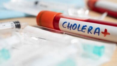 cholera disease