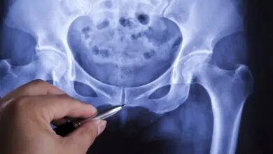 human Pelvis x-ray